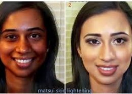 SKIN LIGHTENING +27766119137 PILLS,CREAM,SOAP FOR SALE IN PRETORIA,PRETORIA CENTRAL,SOUTH AFRICA,GAUTENG