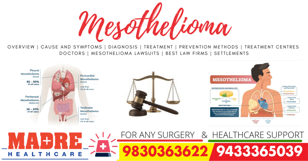 Mesothelioma Treatment Lawyer Mesothelioma Lawsuit Law Firm